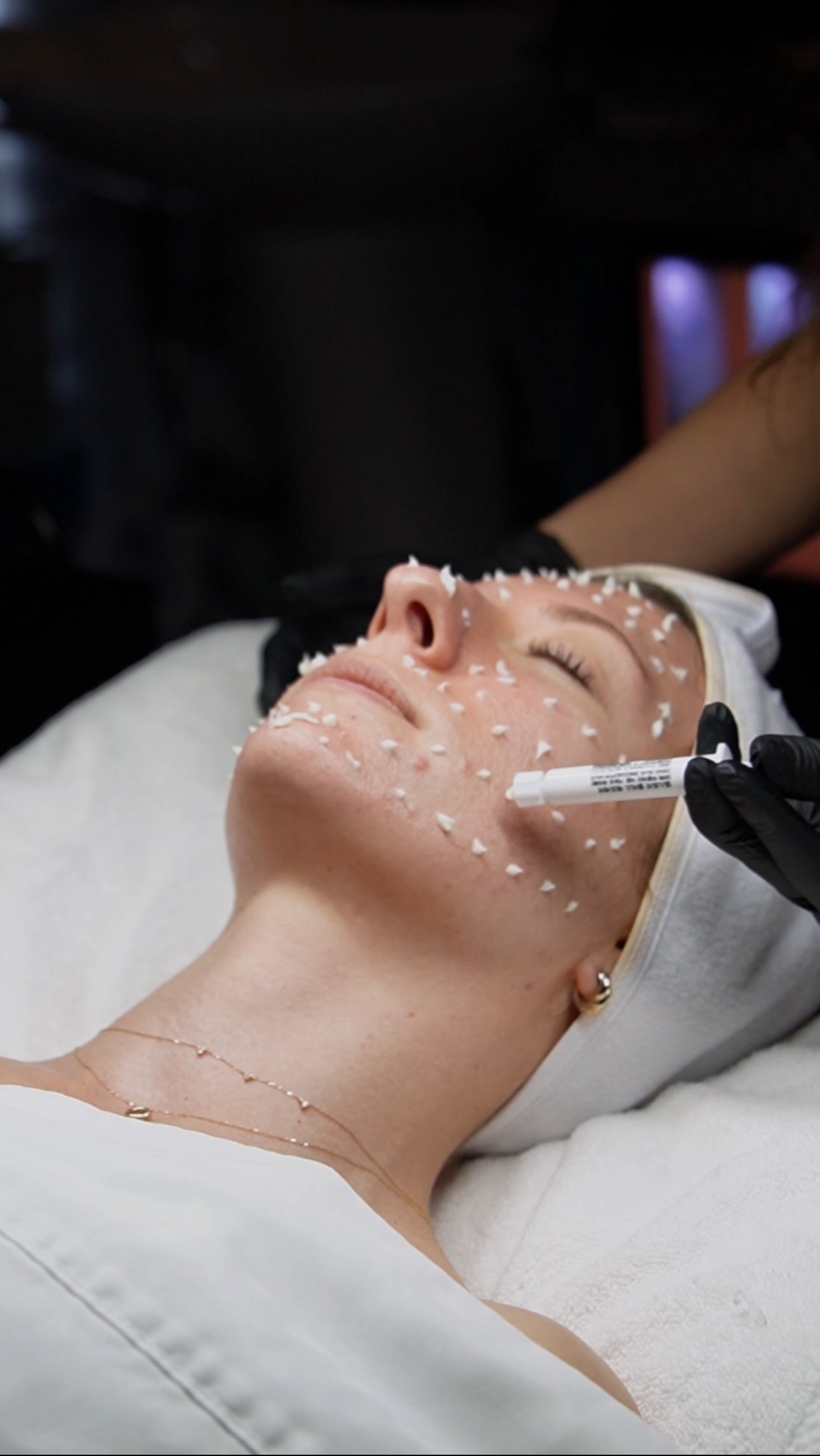 Unlock Radiant Skin with CellStory Liquid Microneedling